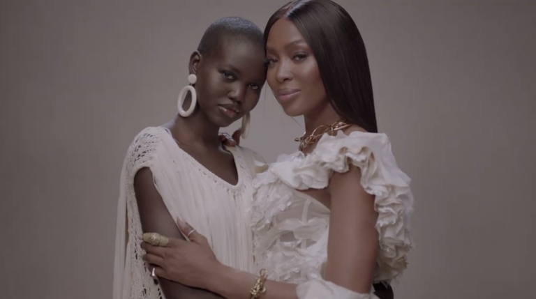 Supermodel Aweng Ade Chuol Is An Advocate For Refugee Mental Health