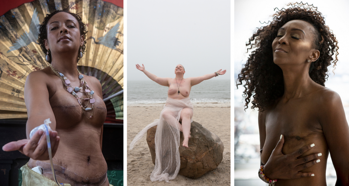 The Grace Project Is Facing Breast Cancer Through Photography: "We Get to See Women Transform into Goddesses"